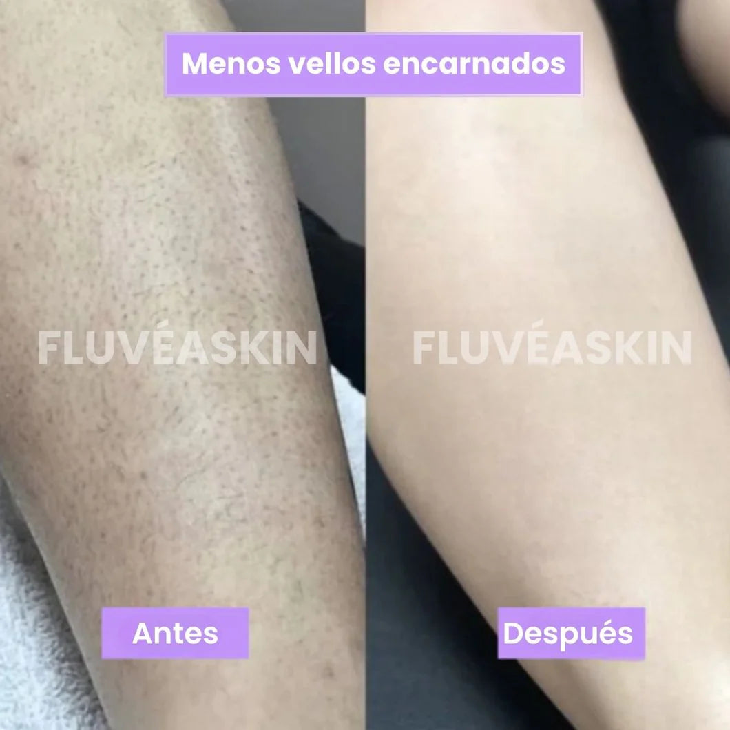 FluveaSkin® - Vello Más Fino y Menos Visible con Raiz de Cyperus Rotundus