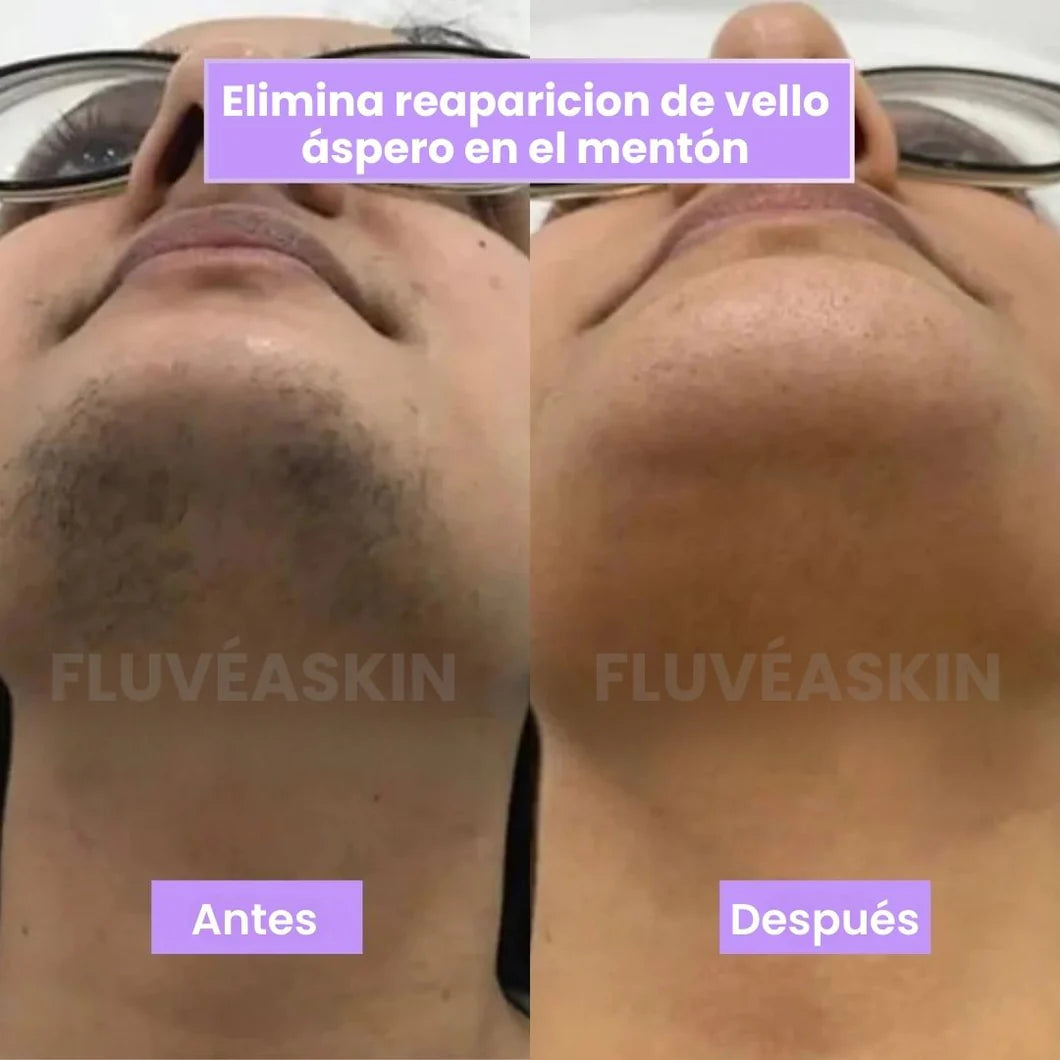 FluveaSkin® - Vello Más Fino y Menos Visible con Raiz de Cyperus Rotundus