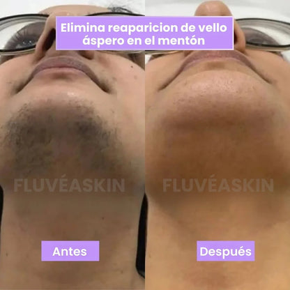 FluveaSkin® - Vello Más Fino y Menos Visible con Raiz de Cyperus Rotundus