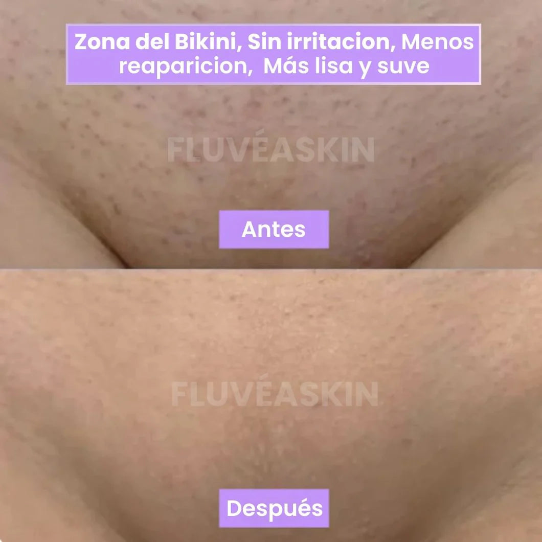 FluveaSkin® - Vello Más Fino y Menos Visible con Raiz de Cyperus Rotundus