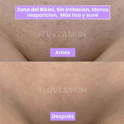 FluveaSkin® - Vello Más Fino y Menos Visible con Raiz de Cyperus Rotundus